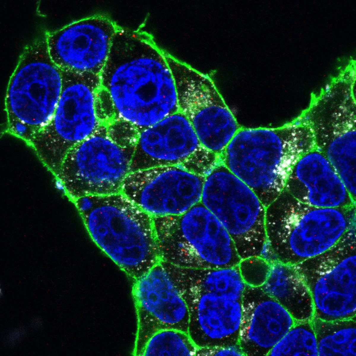 ACE2 receptor and spike protein colocalization on epithelial cells