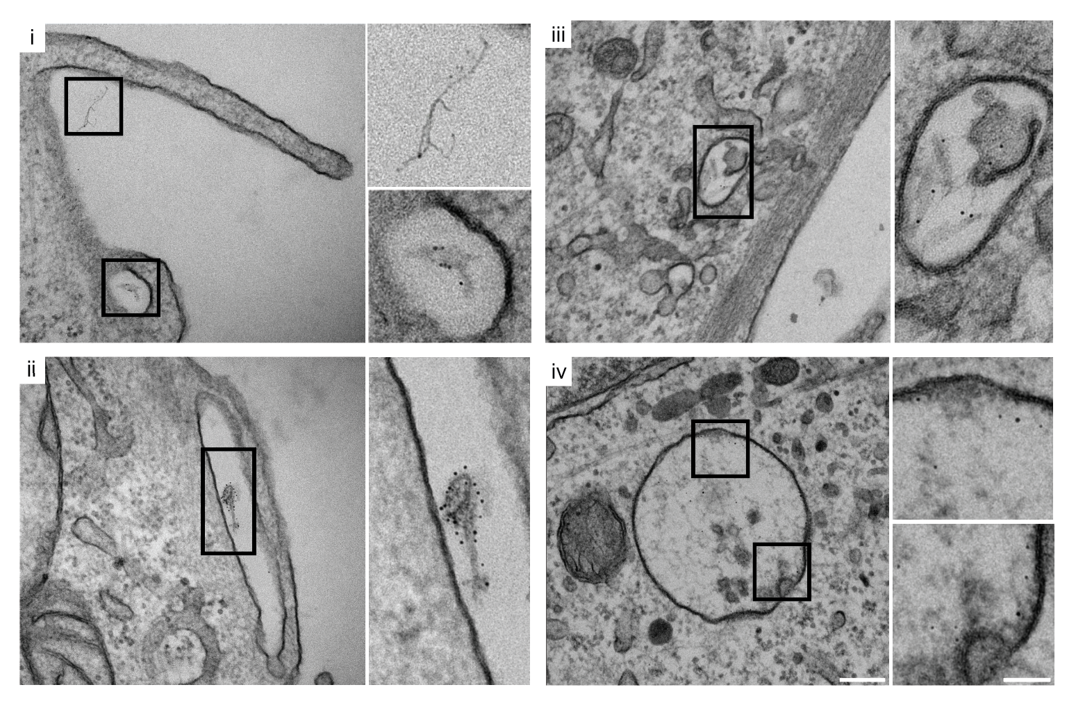 EM panels (i–iv): Nanogold-labeled fibrils at plasma membrane, macropinocytosis initiation, macropinosomes, and nascent MVB
