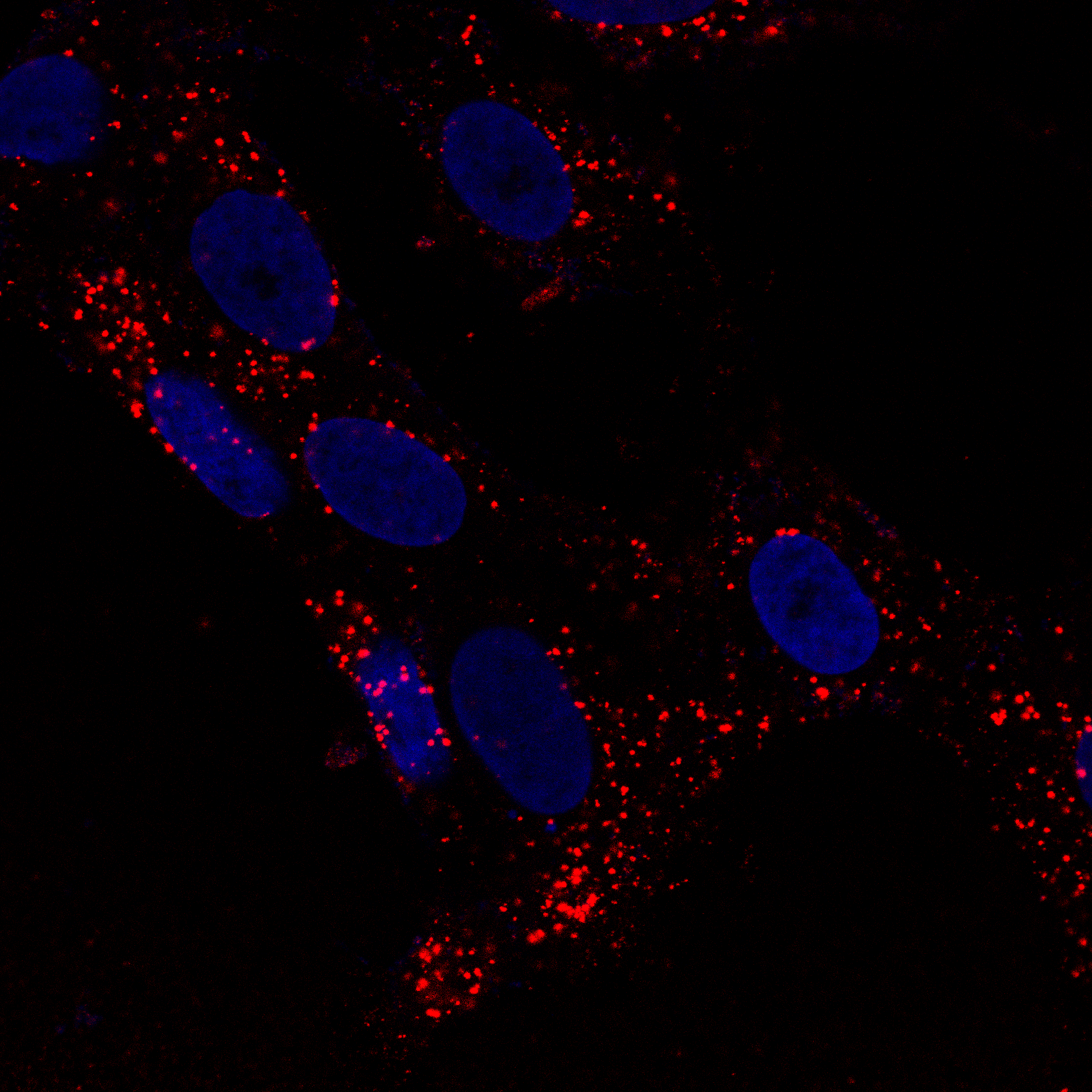 Confocal: SARS-CoV-2 spike protein internalization via clathrin pathway