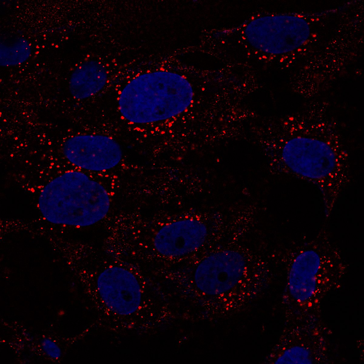 Spike protein uptake at 15 minutes with DAPI nuclear stain