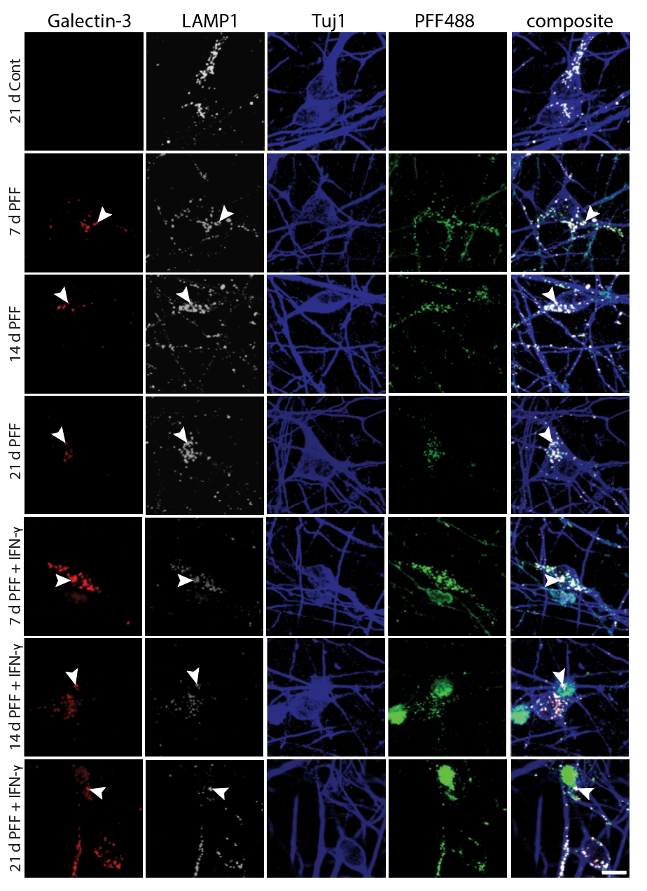 Confocal panels showing microglia (white), PFF488 (green), and Tuj1 composite (blue) across receptor conditions: No receptors control, IFNGR1, TNFR2, IL1R1, triple receptor, and EGFR. Arrowheads mark PFF aggregates near neuronal processes.