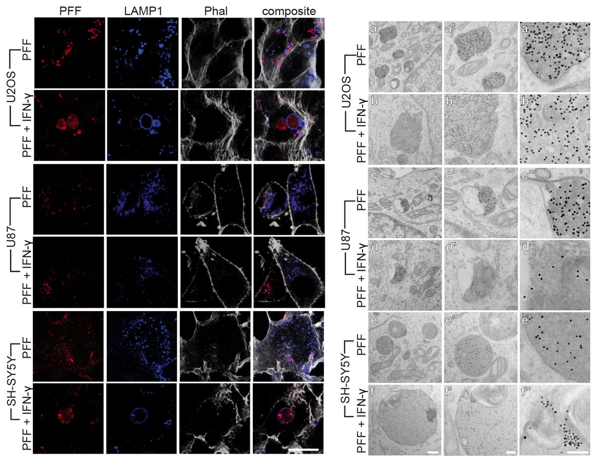 PFF LAMP1 Phalloidin panels across cell lines with and without IFN-gamma