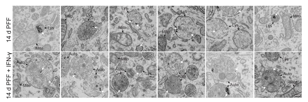 EM showing IFN-gamma induced dysfunctional organelle morphology
