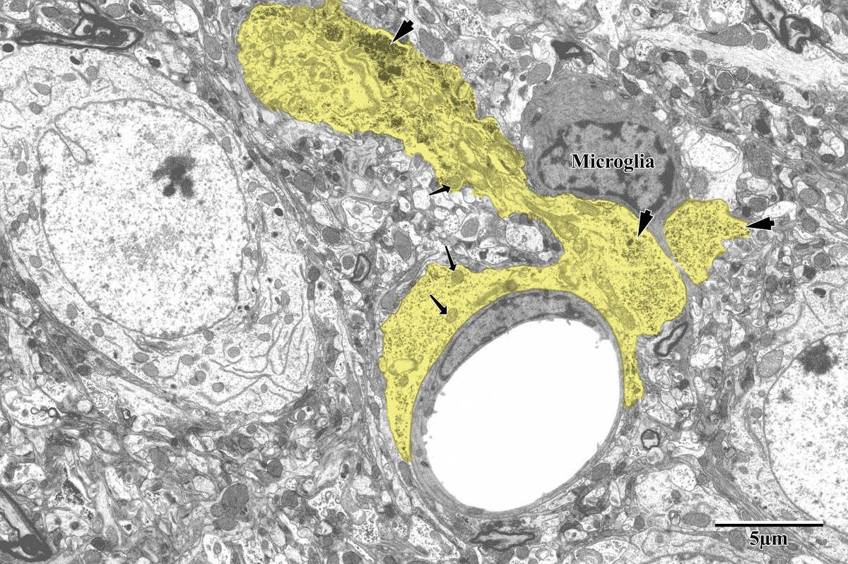 Astrocytic endfeet around capillary with microglia