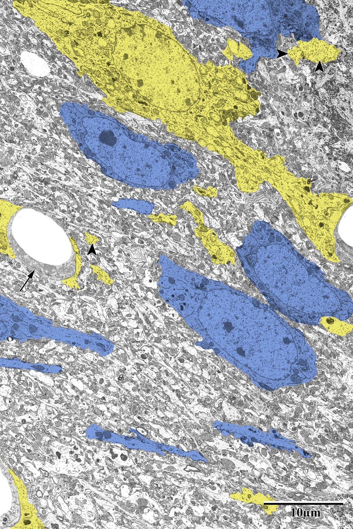 Pseudocolored astrocytes (yellow) surrounding neurons (blue) in peri-infarct zone