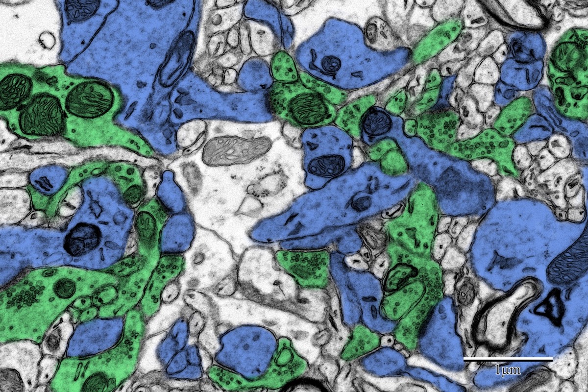 Pseudocolored pre-synaptic (green) and post-synaptic (blue) structures