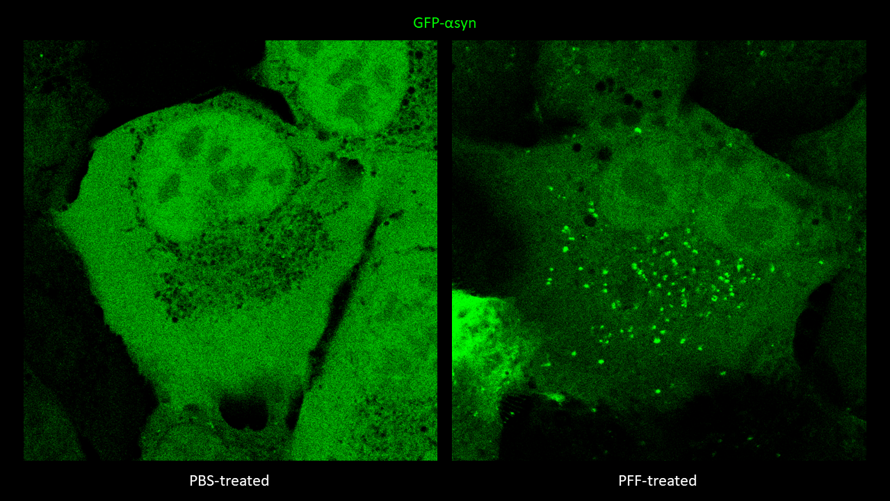 Endogenous α-synuclein aggregation into punctate-like structures in the cytosol