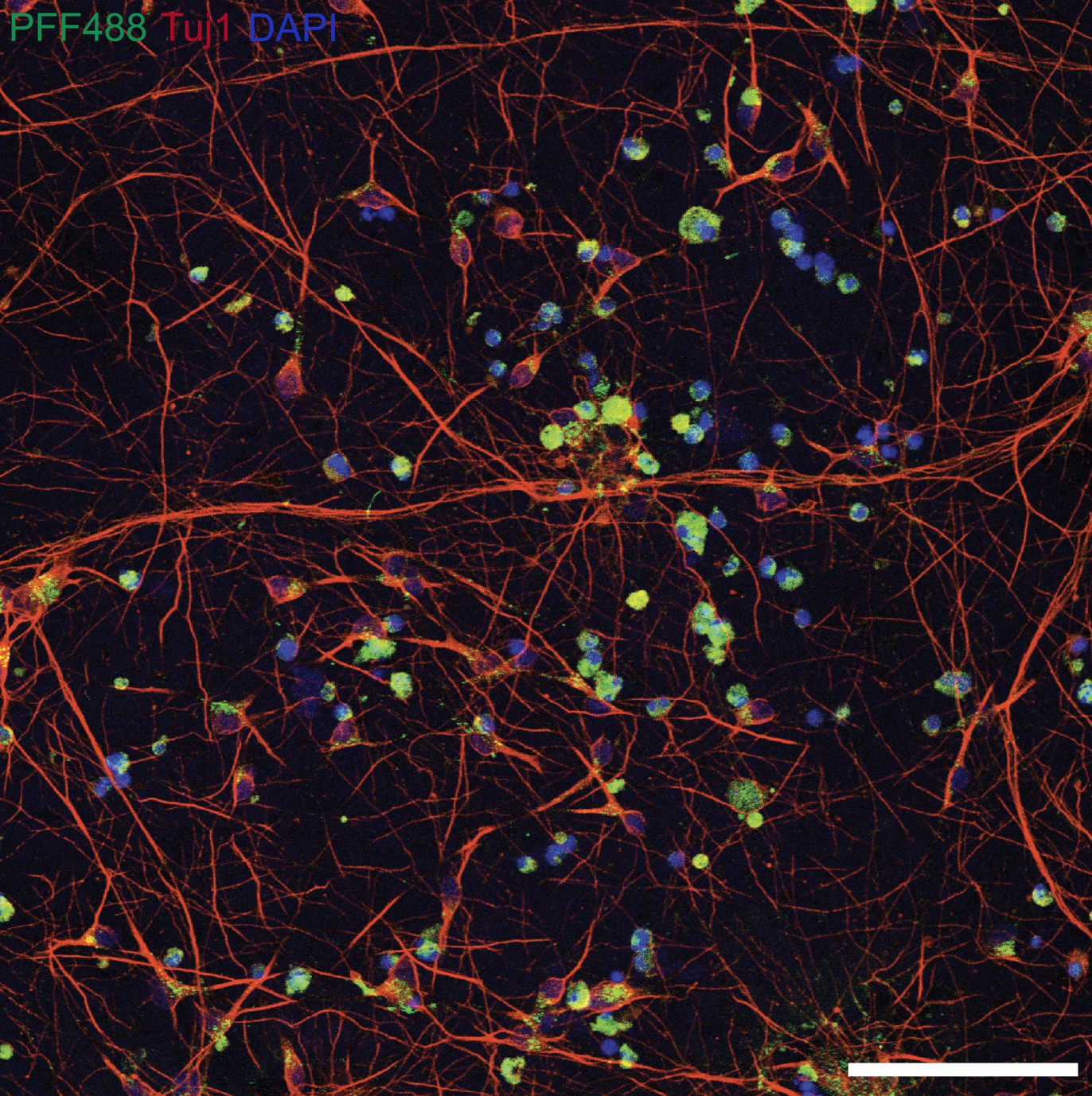 Confocal: DA neurons showing PFF-positive inclusions