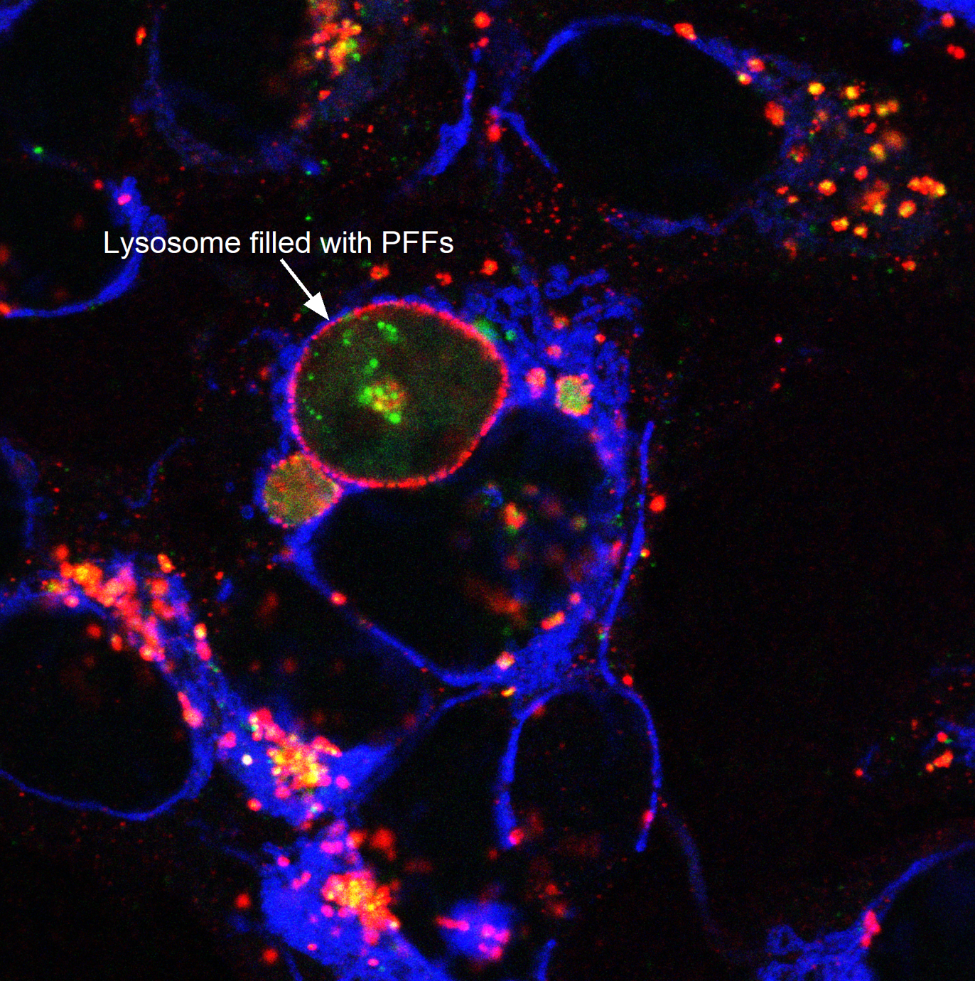 Confocal: Lysosomal dysfunction under cytokine stress