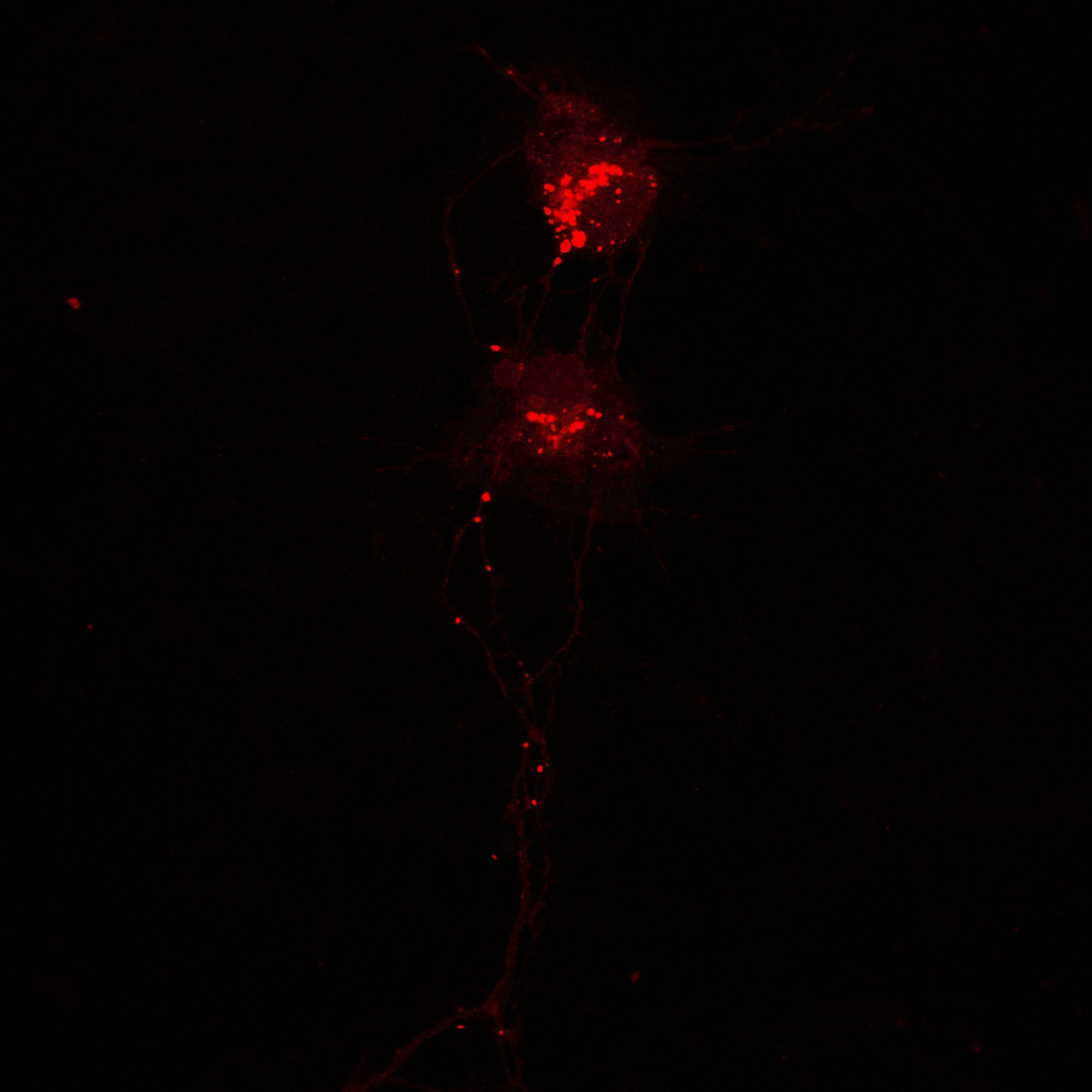 Primary rat hippocampal neuron — LysoTracker Red staining showing bipolar morphology and lysosomal accumulation