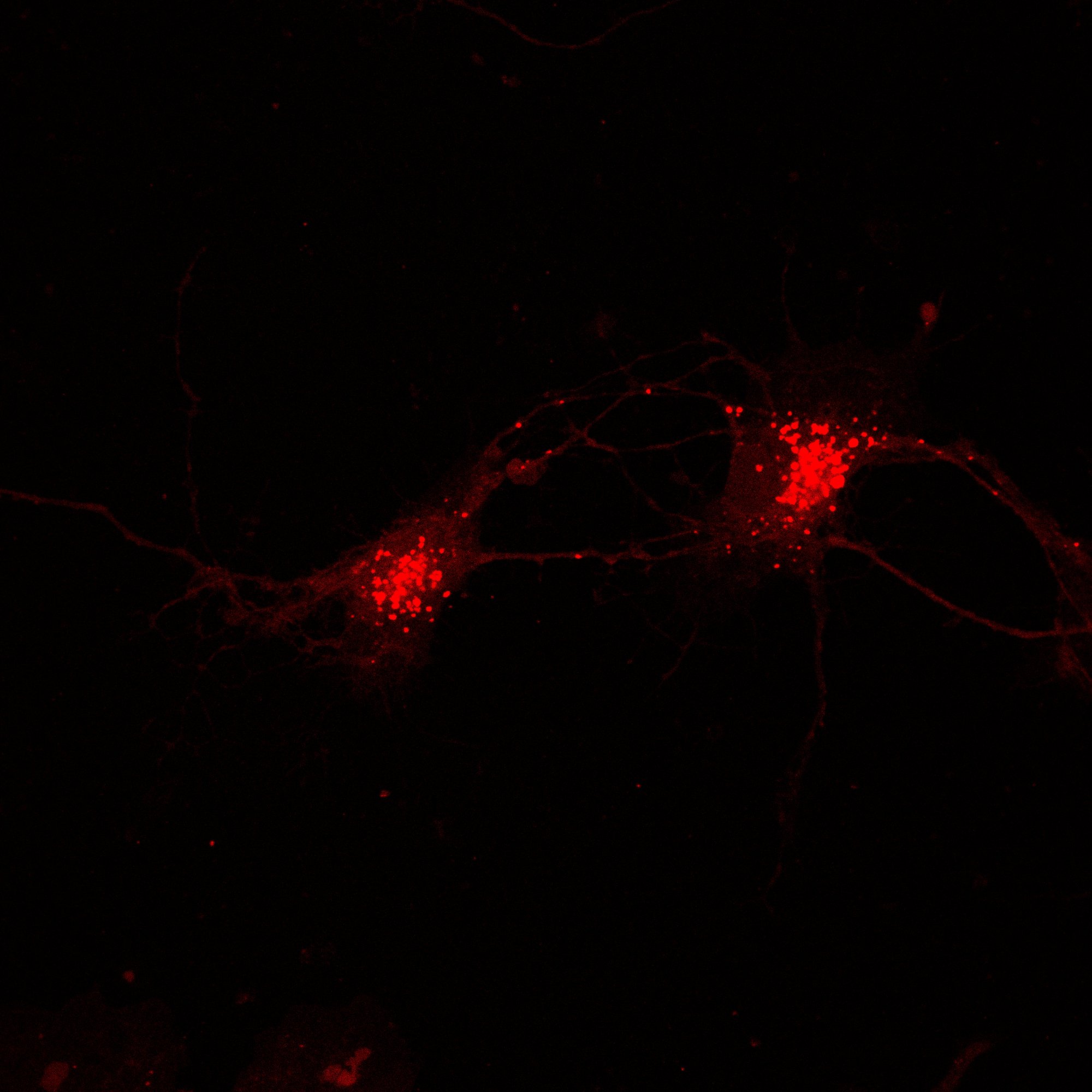 Primary rat hippocampal neurons — 5-minute LysoTracker exposure showing paired neurons with lysosomal puncta along neurites